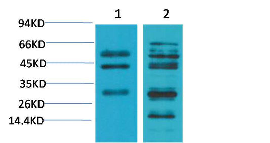 TGFBeta1 Polyclonal Antibody (F259)