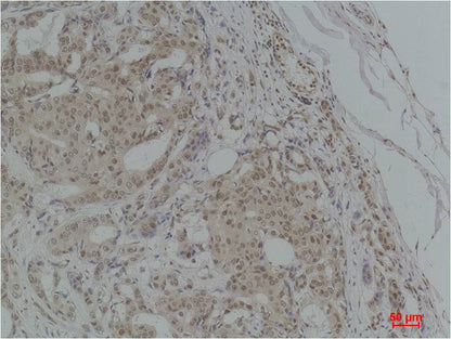 TGFBeta1 Polyclonal Antibody (F259)