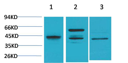 Caspase 8 Polyclonal Antibody (MTDY2)