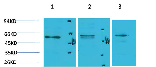 PPAR Gamma Polyclonal Antibody (F226)