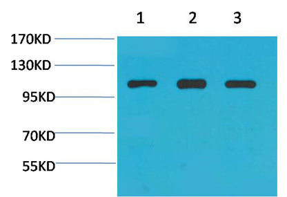 Alpha-actinin Polyclonal Antibody (F298)