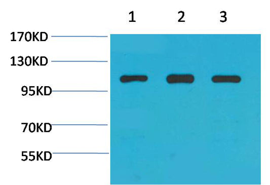 Alpha-actinin Polyclonal Antibody (F298)