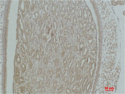 Alpha-actinin Polyclonal Antibody (F298)