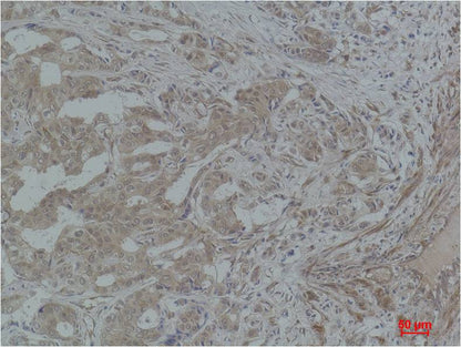 STAT3 Polyclonal Antibody (F246)