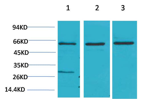 Akt2 Polyclonal Antibody (F204)