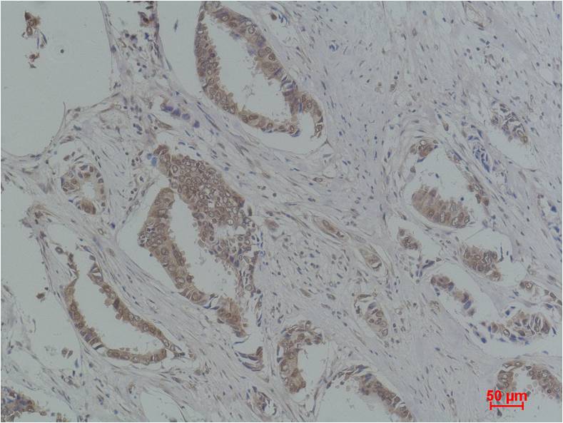 P21 Polyclonal Antibody (F210)