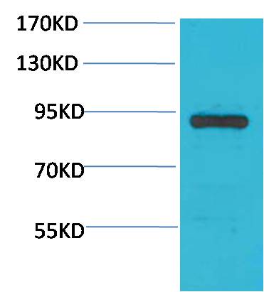 STAT4 Polyclonal Antibody (F248)