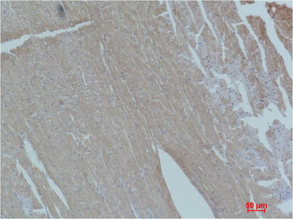 Smad2 Polyclonal Antibody (F231)