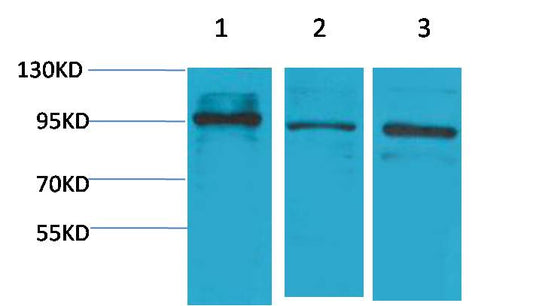 STAT2 Polyclonal Antibody (F244-1)