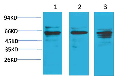 Akt1 Polyclonal Antibody (F201)
