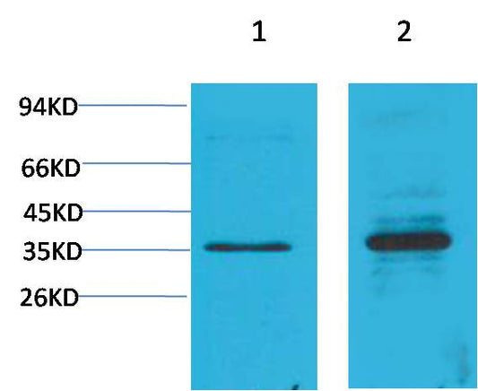 Cyclin D1 Polyclonal Antibody (F279)