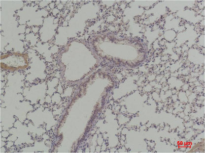 Cyclin D1 Polyclonal Antibody (F279)