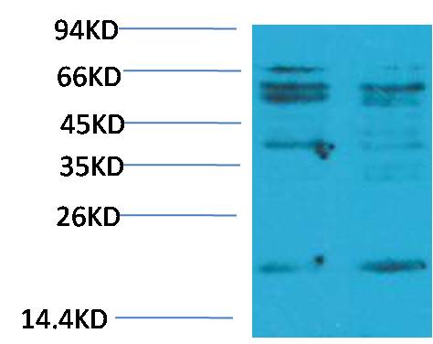 TNF Alpha Polyclonal Antibody (F262)