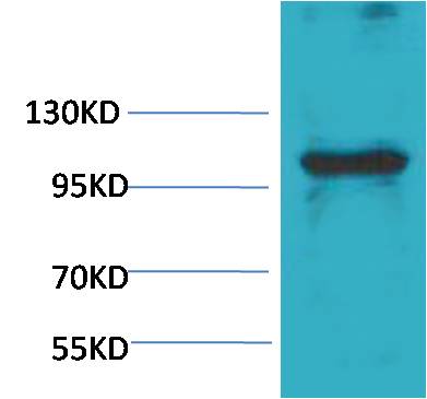 eEF1A2 Binding Protein Polyclonal Antibody (GT)