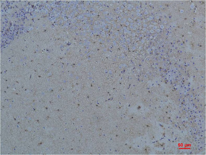 S100 Beta Polyclonal Antibody (F230)