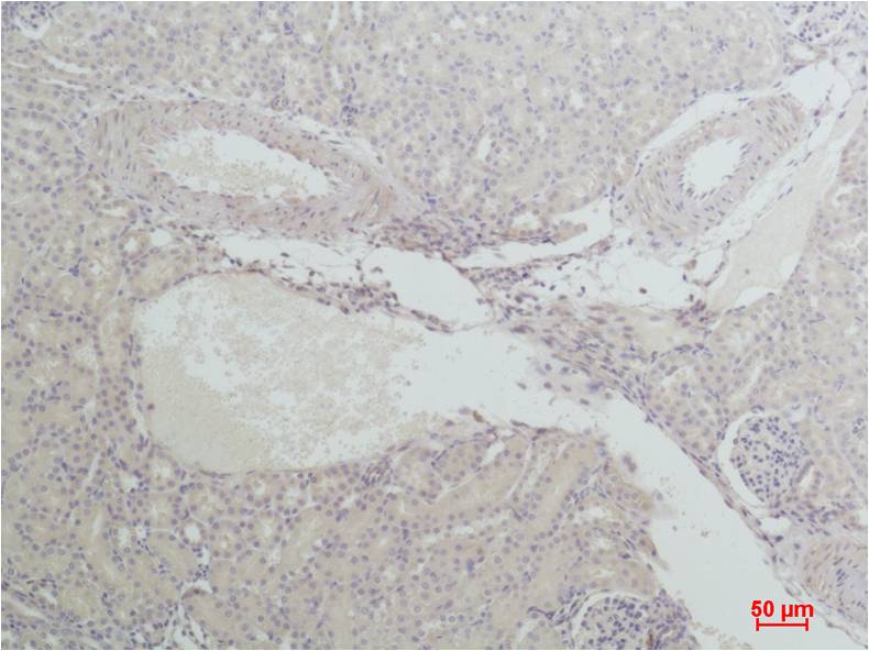 Nrf 2 Polyclonal Antibody (F291)