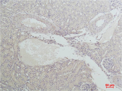 Nrf 2 Polyclonal Antibody (F291)