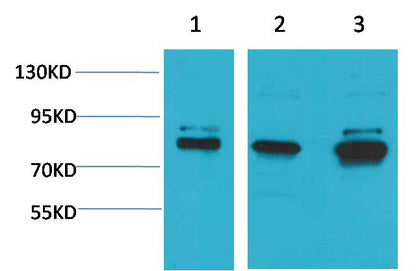 ASIC1 Polyclonal Antibody (A180)