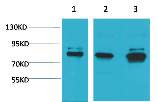 ASIC1 Polyclonal Antibody (A180)