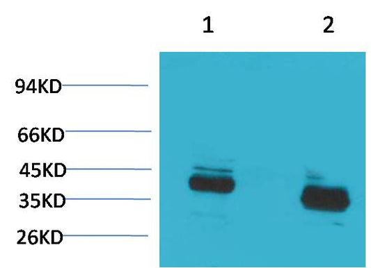 CABP Polyclonal Antibody (A189)