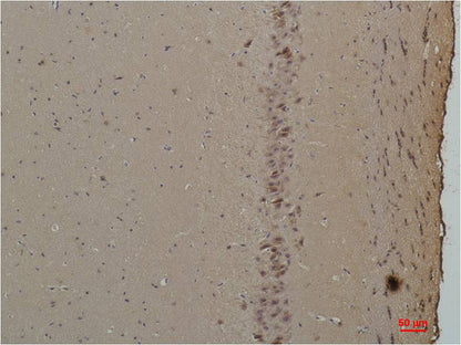 CABP Polyclonal Antibody (A189)