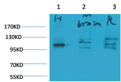 Glutamate Receptor 1 Polyclonal Antibody (A176)