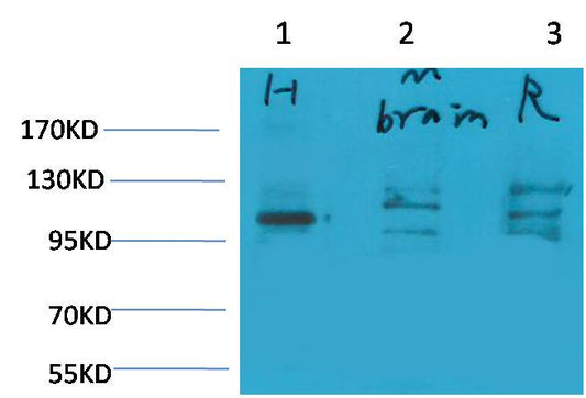 Glutamate Receptor 1 Polyclonal Antibody (A176)