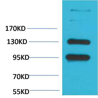 CaVAlpha2Delta1 Polyclonal Antibody (A193)