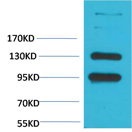 CaVAlpha2Delta1 Polyclonal Antibody (A193)