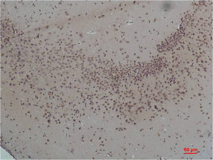 CaVAlpha2Delta1 Polyclonal Antibody (A193)