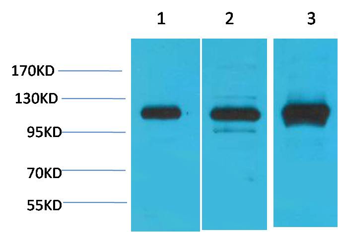 CaVAlpha2Delta2 Polyclonal Antibody (A194)