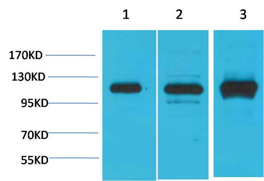 CaVAlpha2Delta2 Polyclonal Antibody (A194)