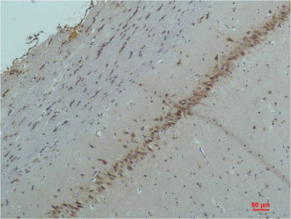 CaVAlpha2Delta2 Polyclonal Antibody (A194)