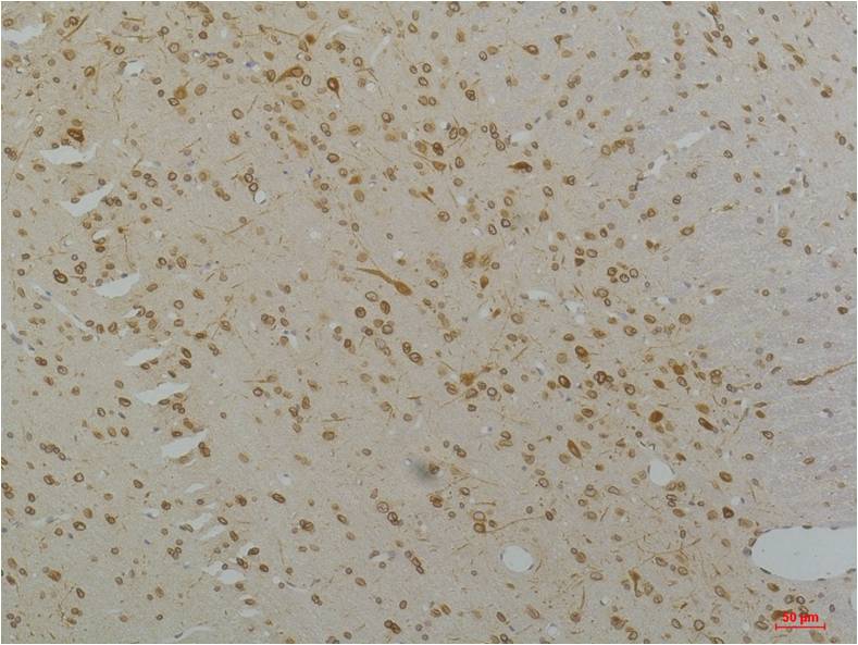CaV1.2 Polyclonal Antibody (A201)