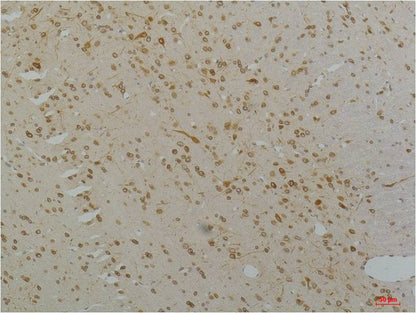 CaV1.2 Polyclonal Antibody (A201)