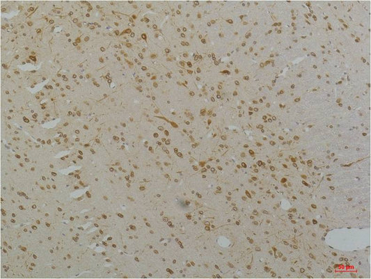 CaV1.2 Polyclonal Antibody (A201)