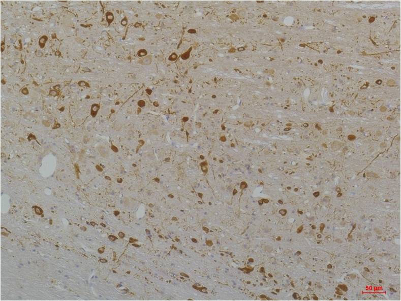 CaV1.3 Polyclonal Antibody (A202)