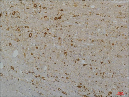 CaV1.3 Polyclonal Antibody (A202)