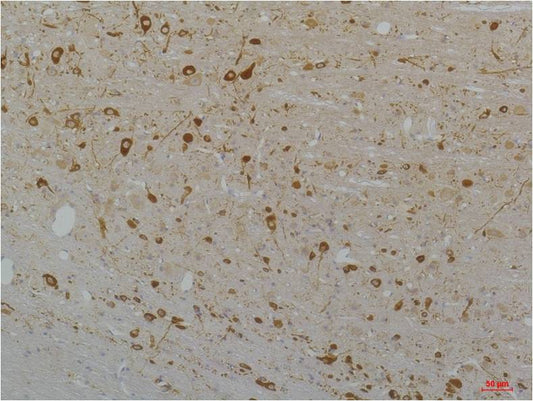 CaV1.3 Polyclonal Antibody (A202)