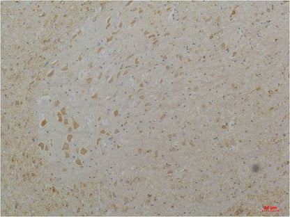 CaV1.3 Polyclonal Antibody (A202)