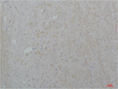CaV2.2 Polyclonal Antibody (A205)