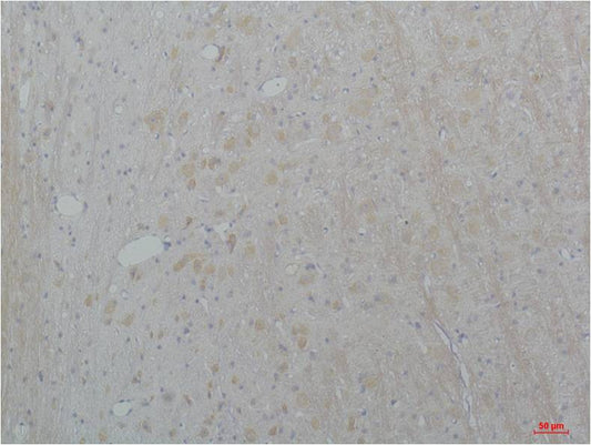 CaV2.2 Polyclonal Antibody (A205)