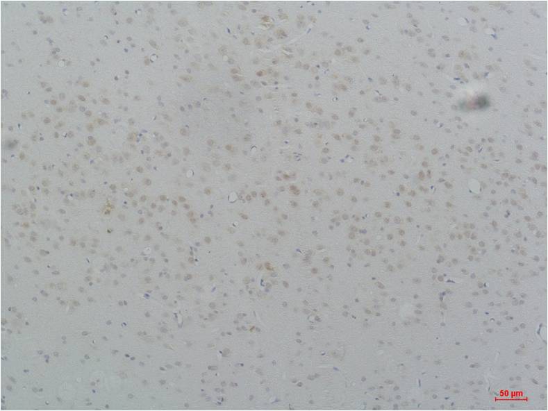 CaV3.2 Polyclonal Antibody (A208)