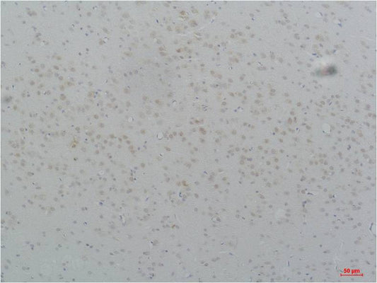 CaV3.2 Polyclonal Antibody (A208)