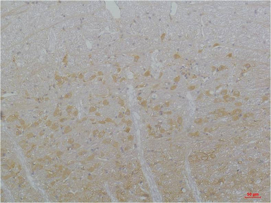 CaV3.3 Polyclonal Antibody (A209)