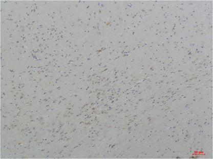 CaV3.3 Polyclonal Antibody (A209)