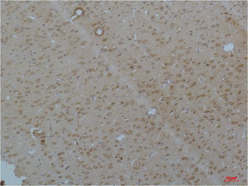 CaV pan Alpha Polyclonal Antibody (A211)