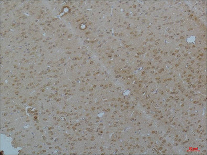 CaV pan Alpha Polyclonal Antibody (A211)
