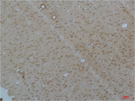 CaV pan Alpha Polyclonal Antibody (A211)