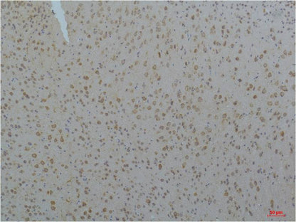 CaV pan Alpha Polyclonal Antibody (A211)